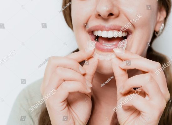 stock-photo-smiling-woman-with-a-snow-white-smile-demonstrate-clear-teeth-aligner-for-orthodontal-straightening-2493948777